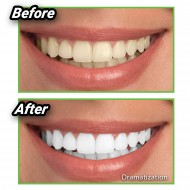 Miracle Teeth - természetes szén a fogfehérítéshez